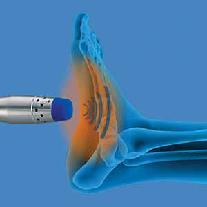 enPulsPro foot heel pain RW blue web
