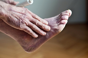 What Can Cause Poor Foot Circulation?
