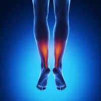 Injuries to the Achilles Tendon